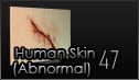 Human Skin (Abnormal)