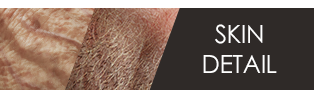 Skin Detail