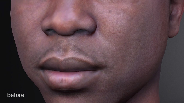 Skin texture upscaler enhancing fine skin detail from a low-resolution source image