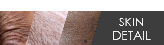 Skin Detail