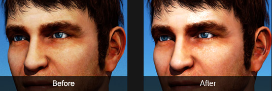Skin enhancement